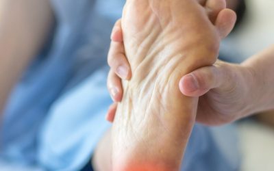 Is Physical Therapy Beneficial for Treating Plantar Fasciitis?