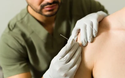 Exploring Functional Dry Needling: A Physical Therapist’s Perspective